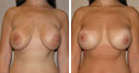 Before & After Photos